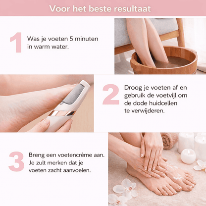 SOLEA™ PediCare - Verwijder eelt en krijg zijdezachte voeten gewoon thuis