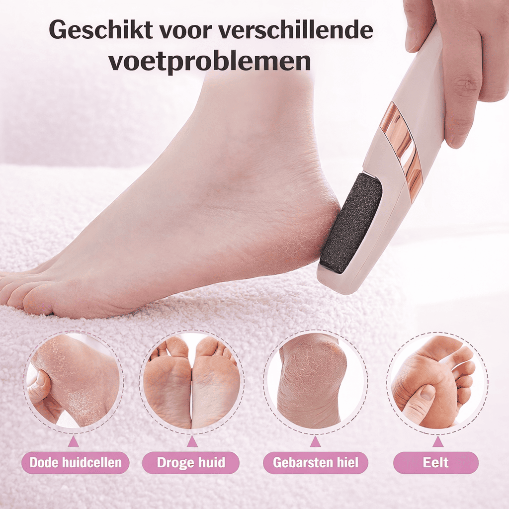 SOLEA™ PediCare - Verwijder eelt en krijg zijdezachte voeten gewoon thuis